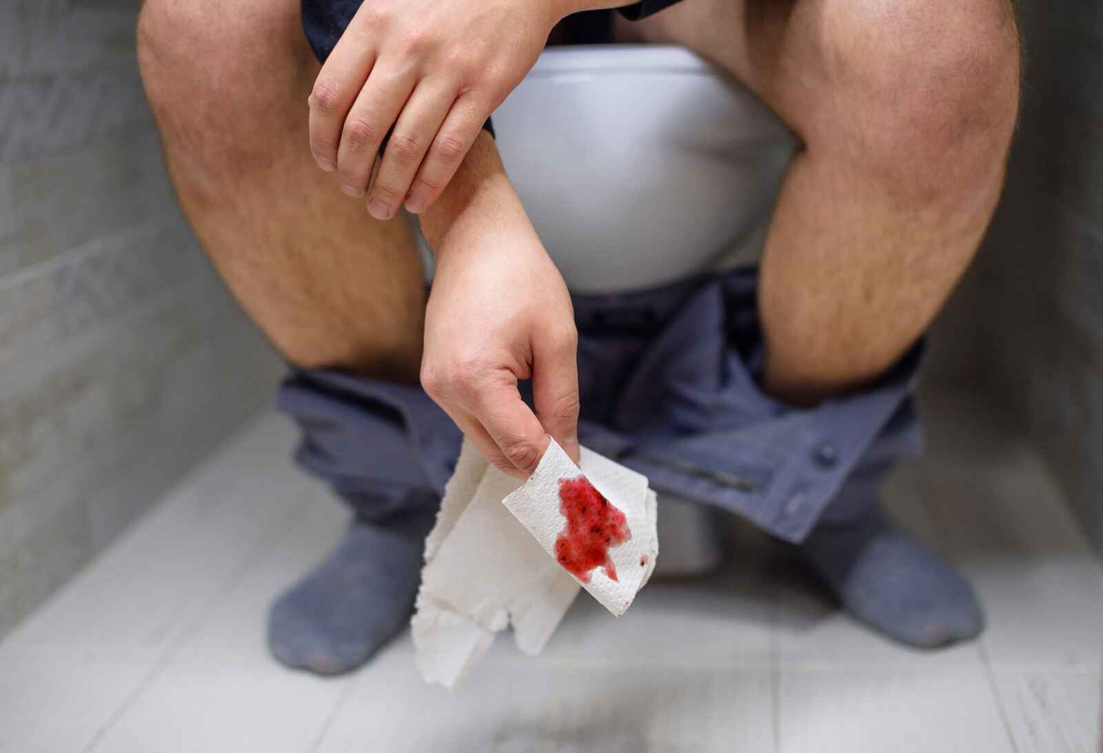 Symptoms of blood in stool include bright red blood, dark red blood, and mucus, often accompanied by pain or diarrhea, requiring medical attention.