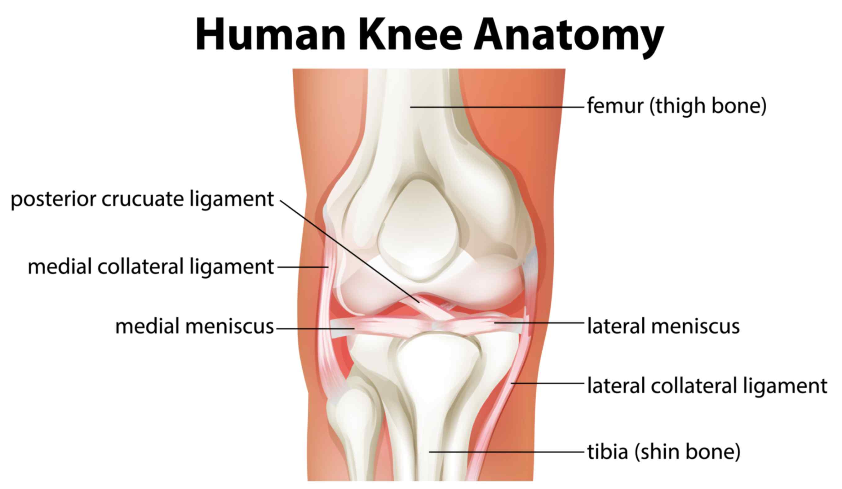 Types of knee pain